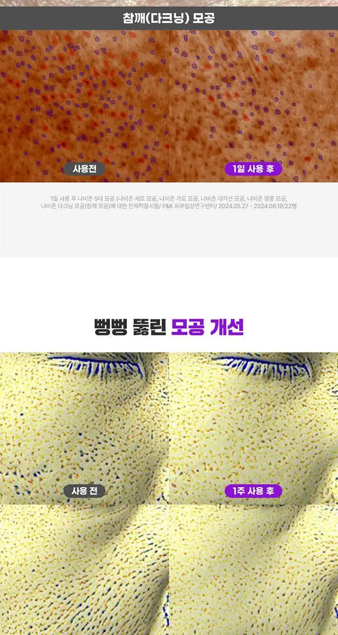 [단독기획/대용량] 파티온 노스카나인 트러블 모공탄력 세럼 50ml 기획(+5ml+크림 5ml) 상세페이지 18
